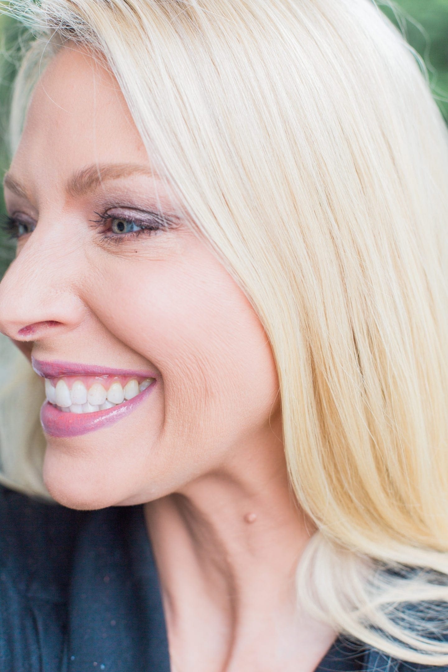 Restylyne Defyne for under eye filler.