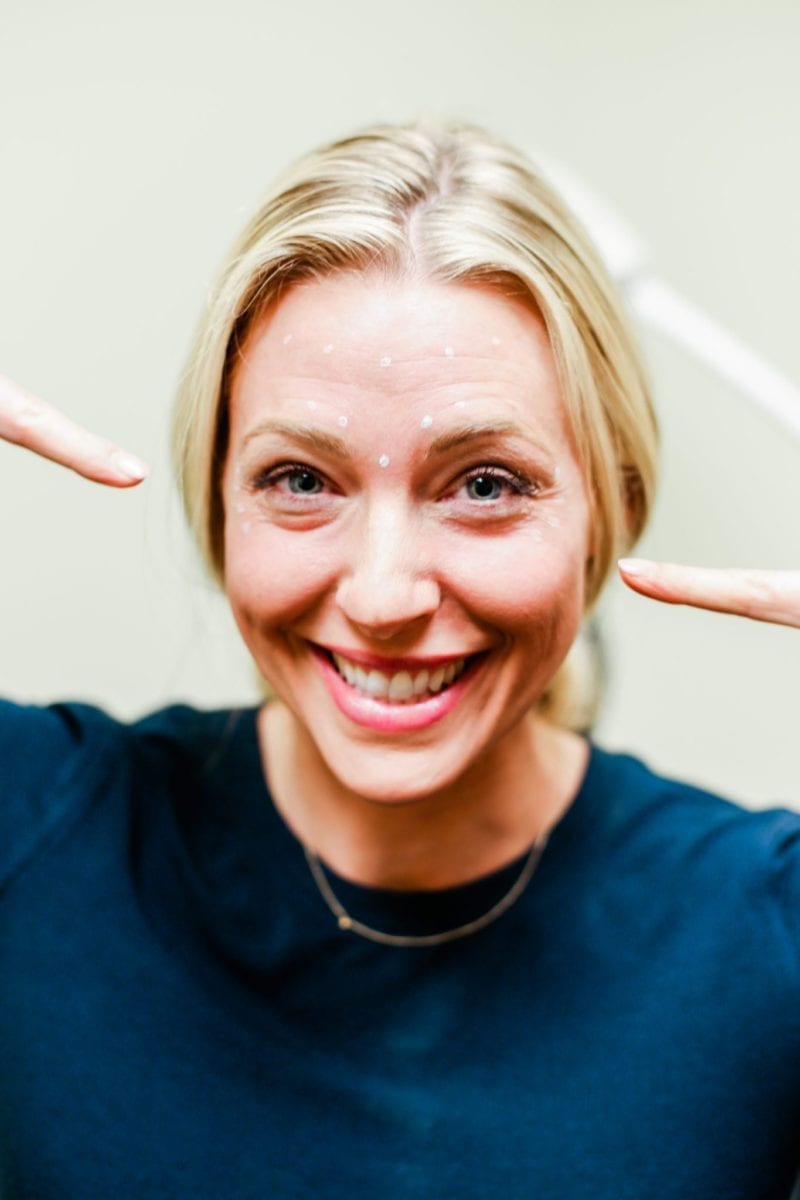 How much botox should I get to smooth my forehead and crows feet?