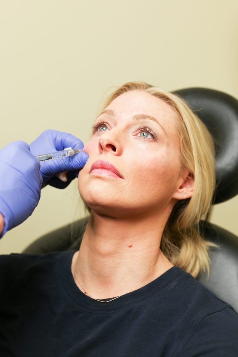What do fillers do and what type of fillers should you get.