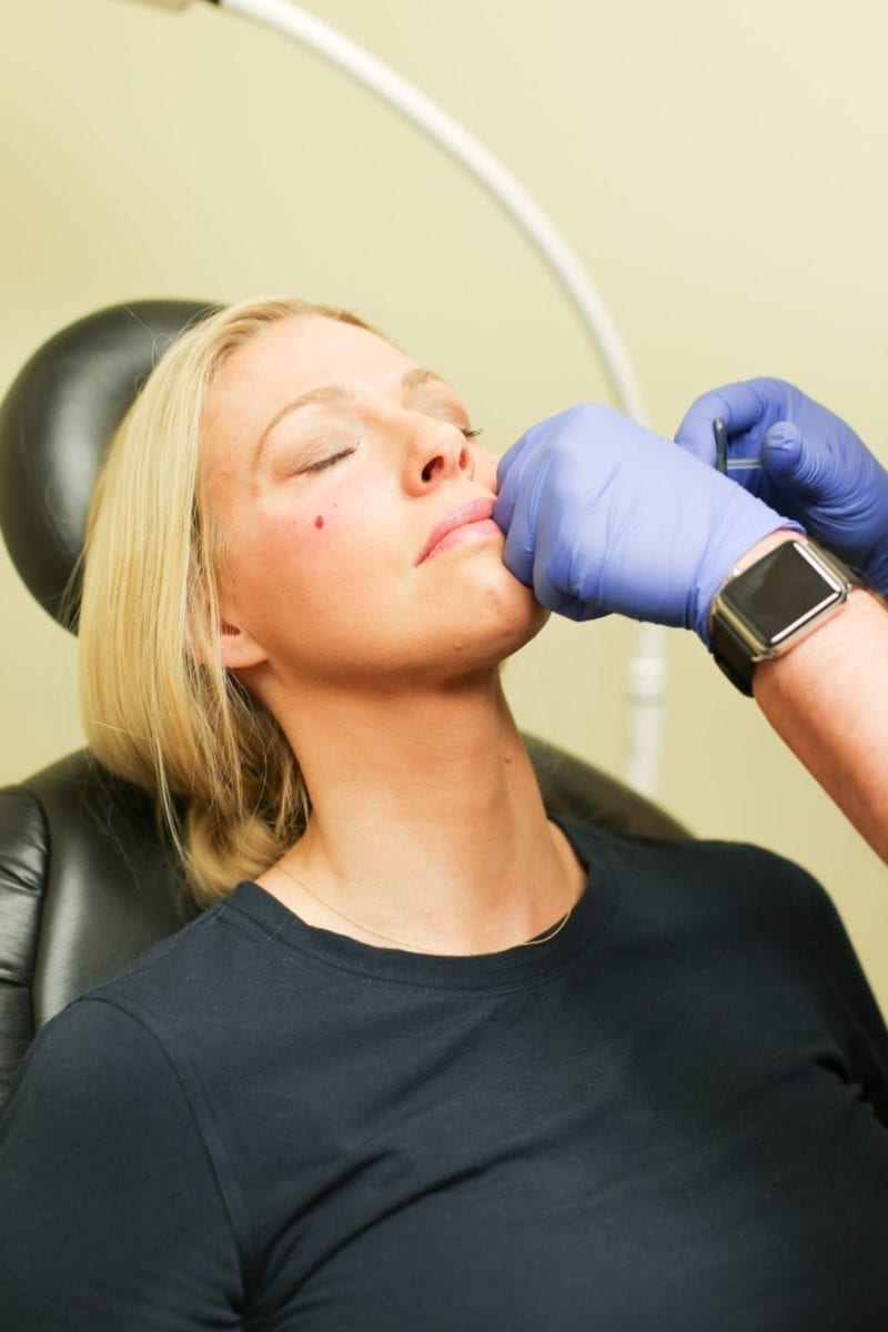Where should I put fillers and what do fillers do for your face.