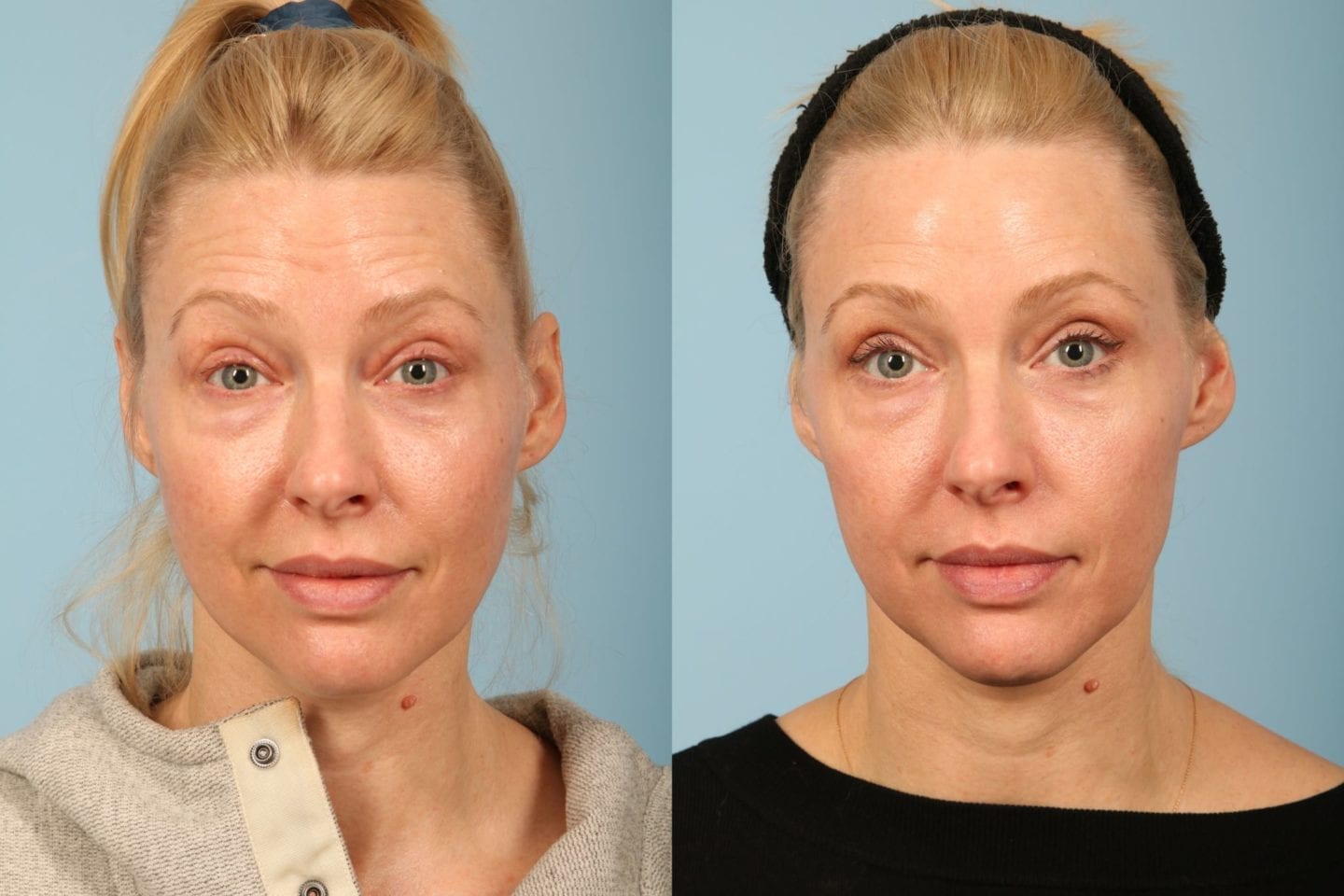 does skinmedica work