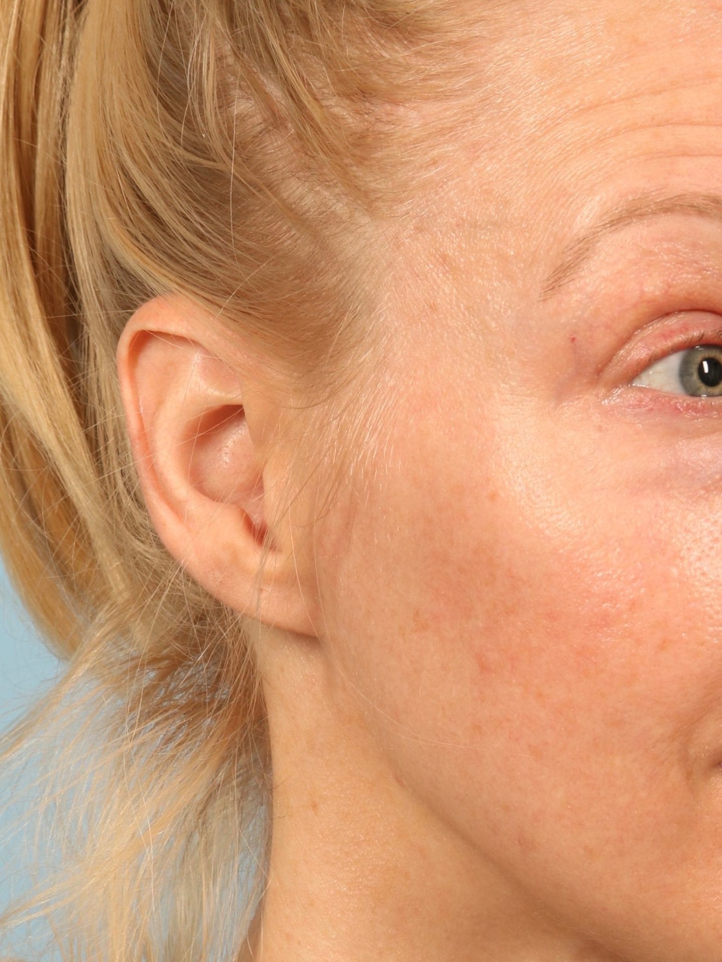 Best SkinMedia for Anti Aging