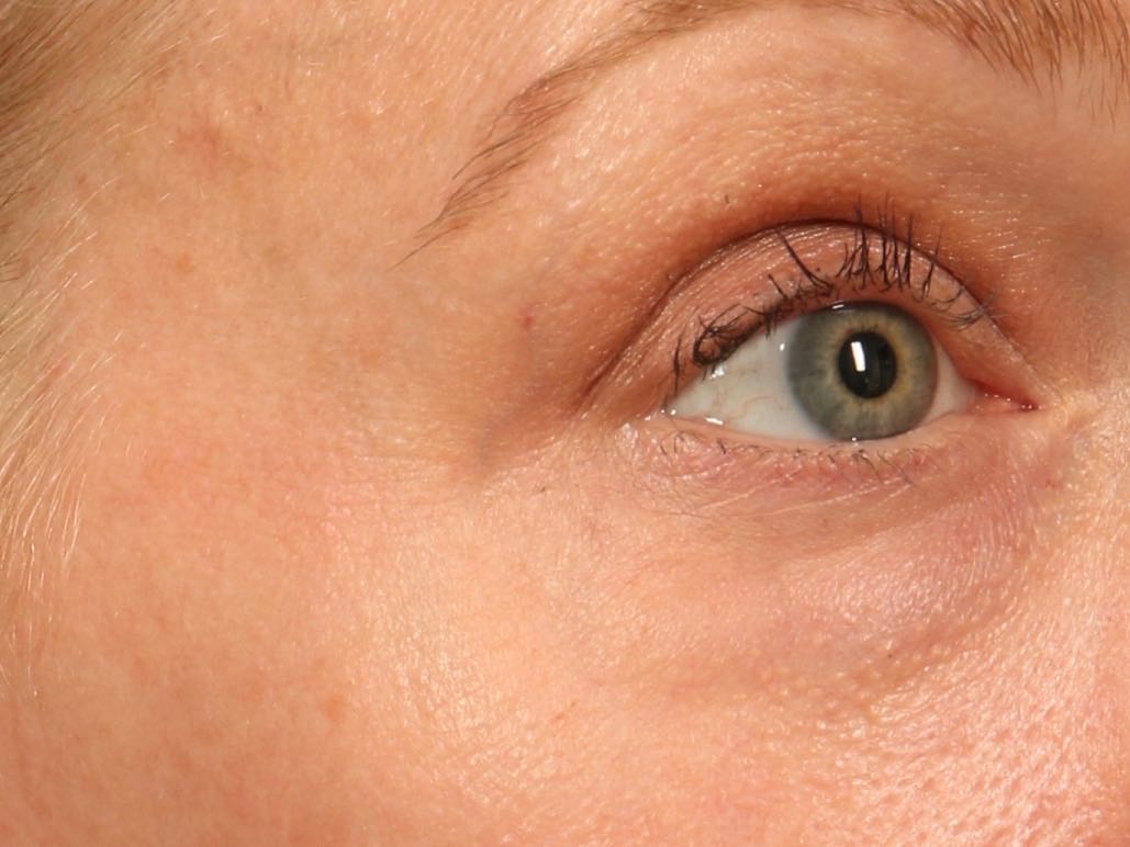 TNS Eye Cream