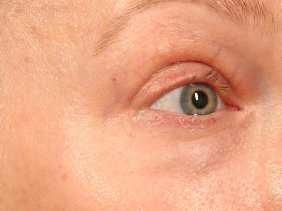 TNS Essentials Eye Repair