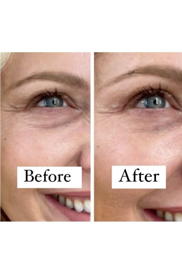 The Revision skincare reviews are in for the Revox Line Releaser. This is my Revision Skincare before and after by beauty influencer Kelly Page for BlueGrayGal.