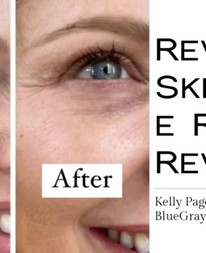 Revox Line Relaxer Before and After