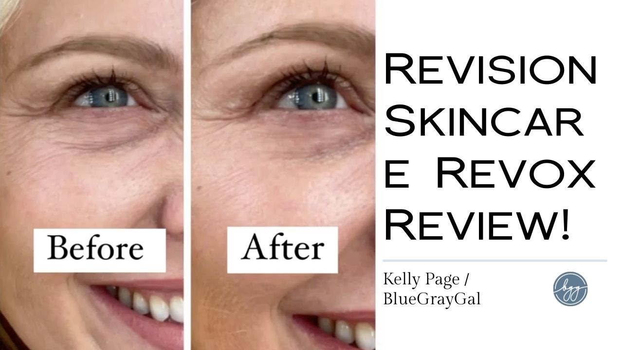 This Revox Line Relaxer Review shows a before and after on beauty influencer Kelly Page for BlueGrayGal.